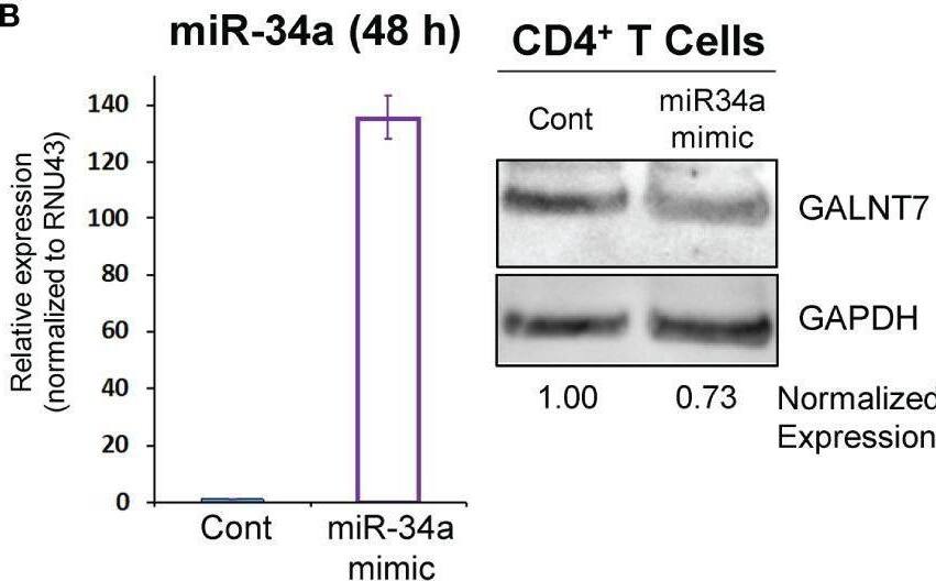 Polypeptide GalNac Transferase 7/GALNT7 Antibody - BSA Free