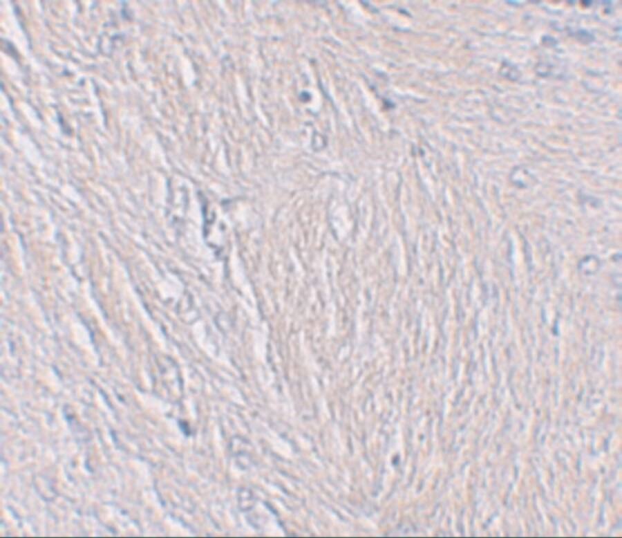 Synaptopodin Antibody - BSA Free