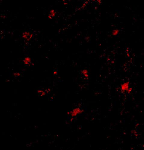 BAIAP3 Antibody - BSA Free