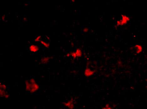 MEX3A Antibody - BSA Free