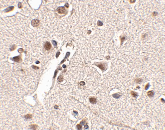 MEX3A Antibody - BSA Free