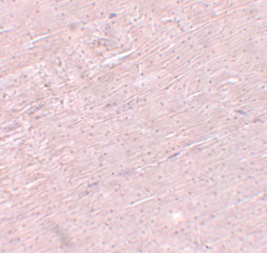 ADAMTSL5 Antibody - BSA Free