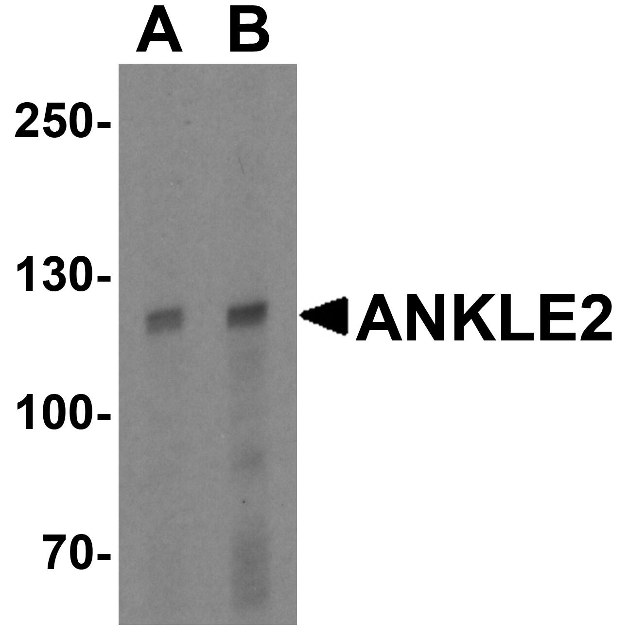 ANKLE2 Antibody - BSA Free