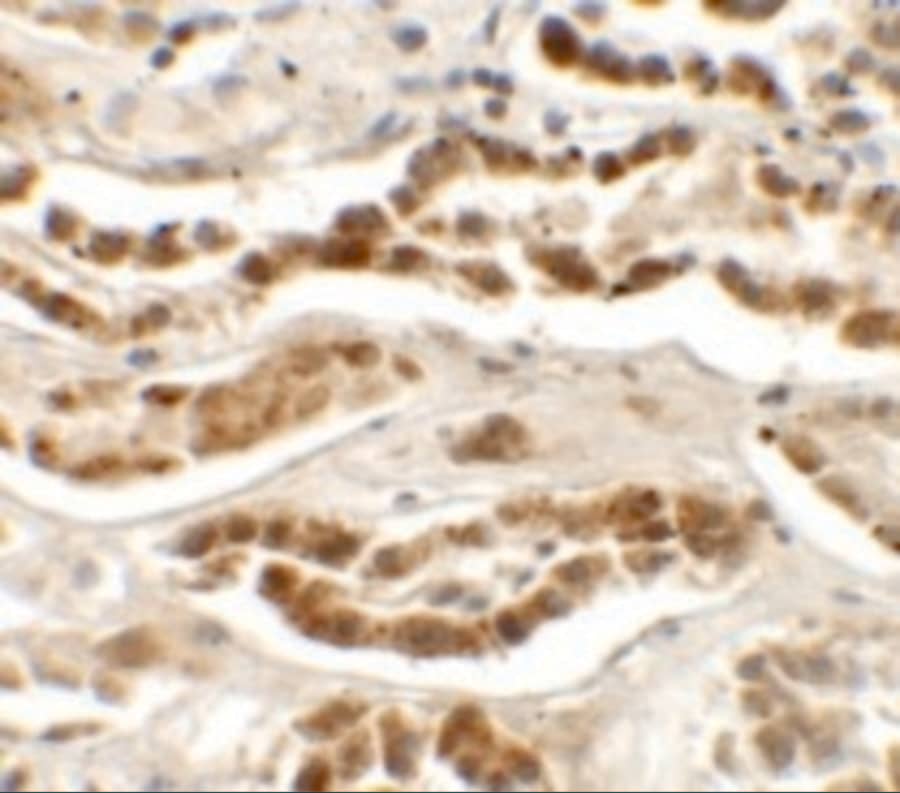 LZTS2 Antibody - BSA Free