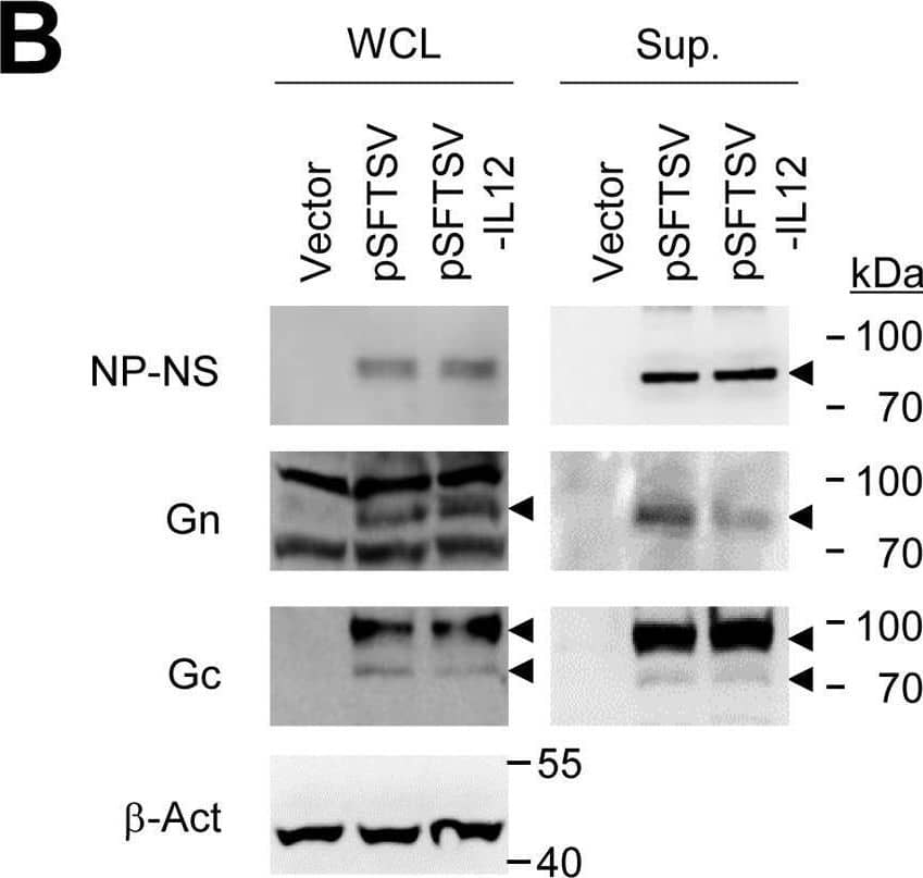 SFTS Virus HB29 Antibody - BSA Free