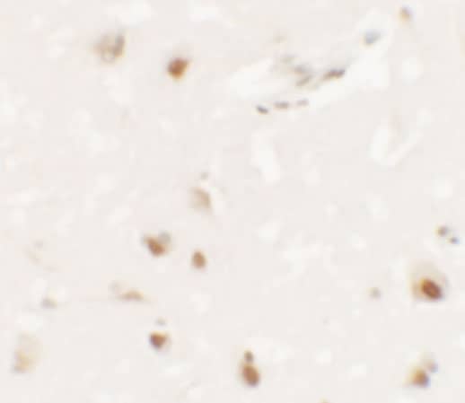 SHANK3 Antibody - BSA Free