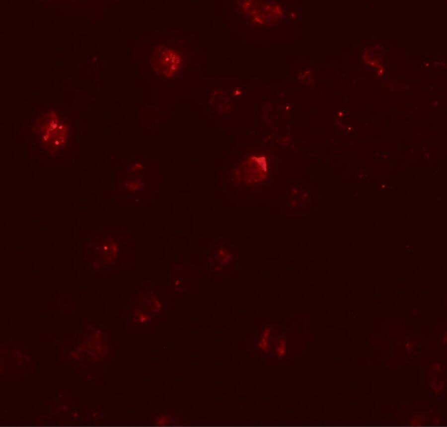 ZNF687 Antibody - BSA Free