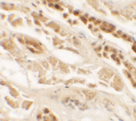 TTYH2 Antibody - BSA Free