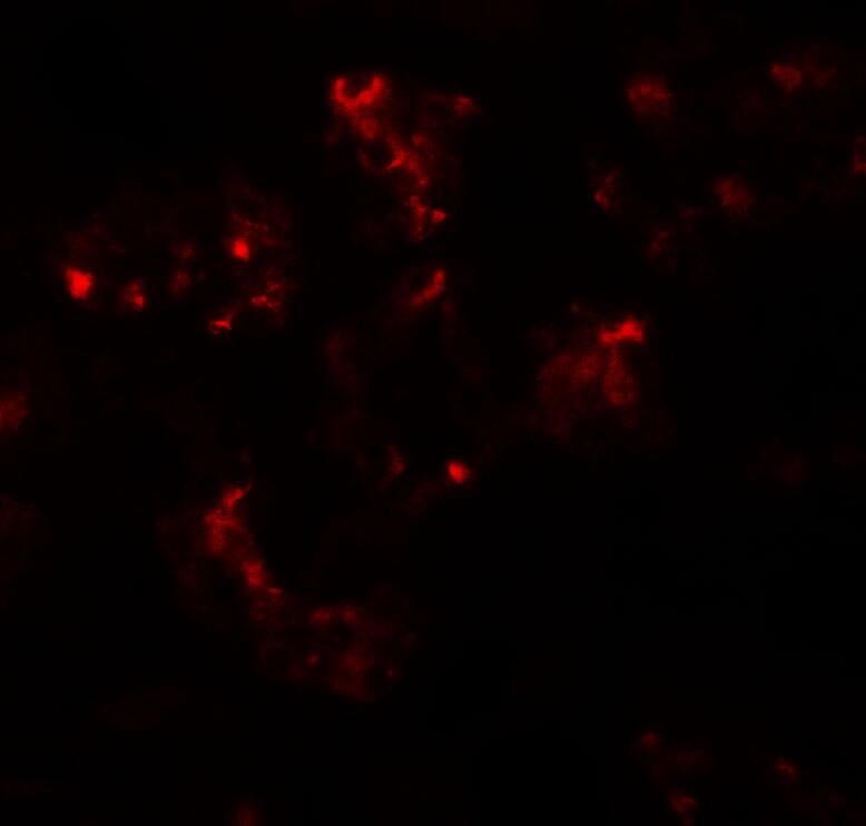 TTYH2 Antibody - BSA Free