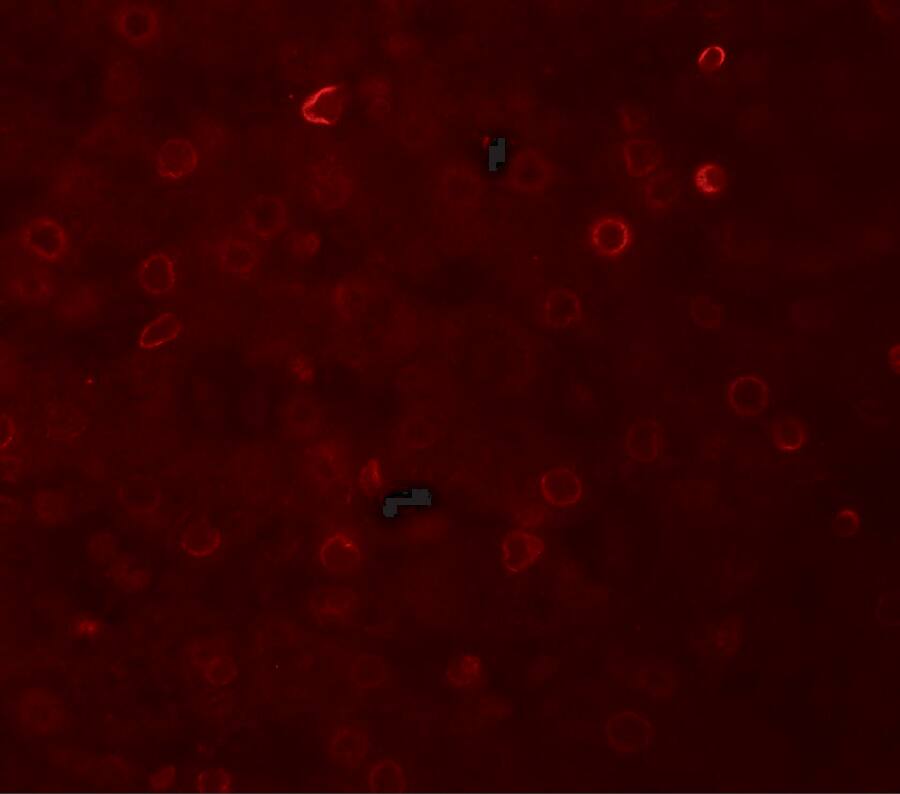 TRACP/PAP/ACP5 Antibody - BSA Free