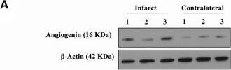 Angiogenin Antibody - BSA Free