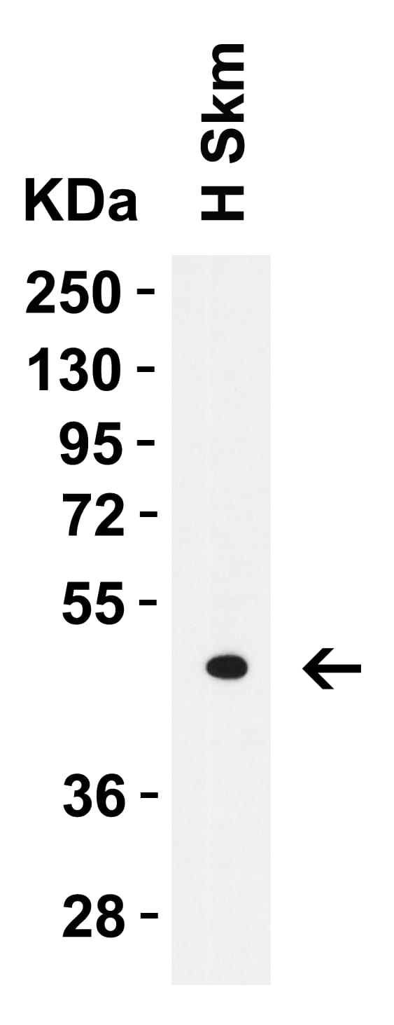 LMX1A Antibody - BSA Free