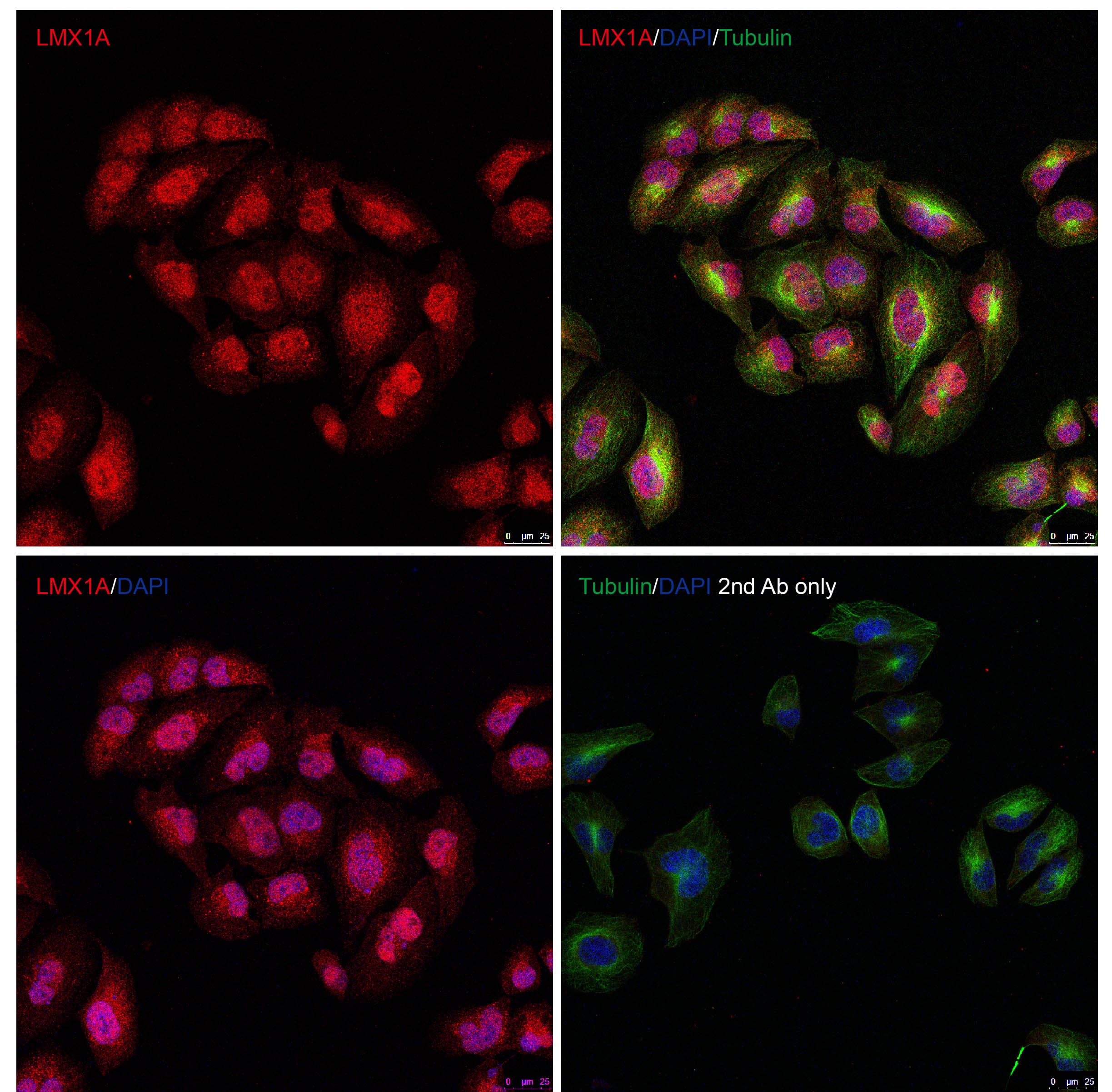 LMX1A Antibody - BSA Free