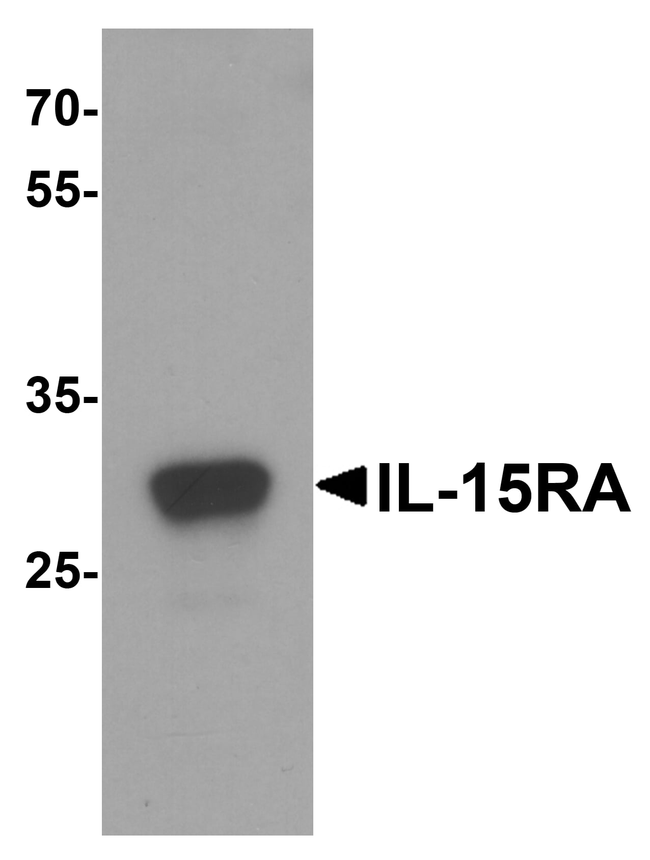 IL-15R alpha Antibody - BSA Free