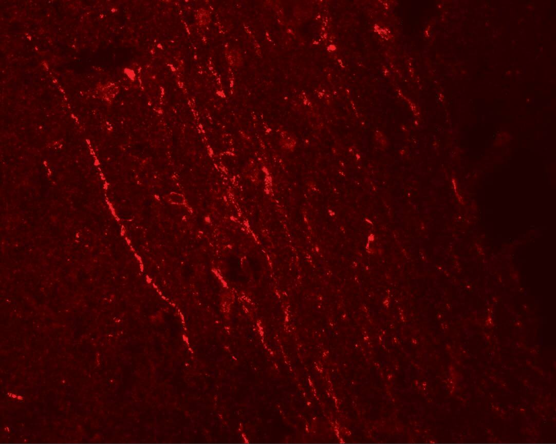 FGFR3 Antibody - BSA Free