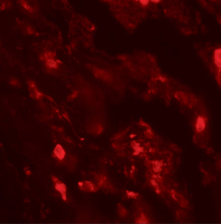 IL-36 beta/IL-1F8 Antibody - BSA Free