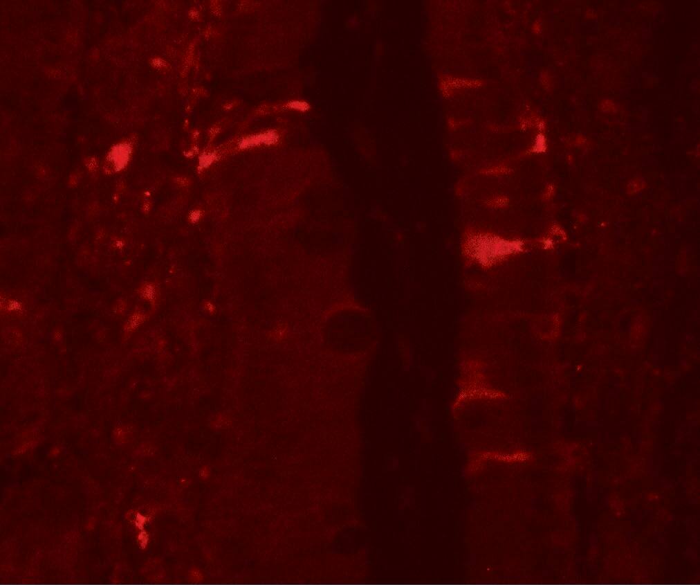 IL-36Ra/IL-1F5 Antibody - BSA Free