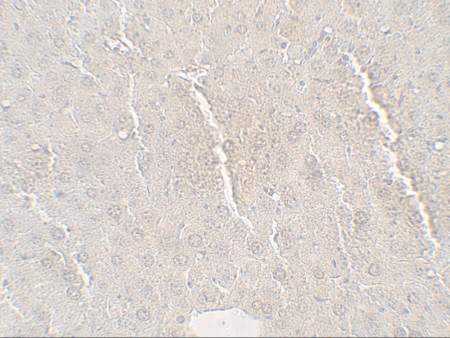 Angiopoietin-like protein 8/Betatrophin Antibody - BSA Free