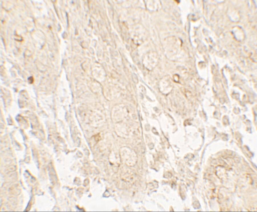 GRK6 Antibody - BSA Free