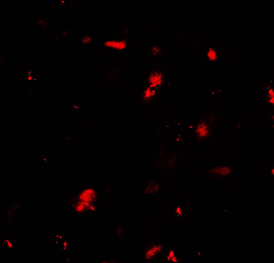 GRK6 Antibody - BSA Free