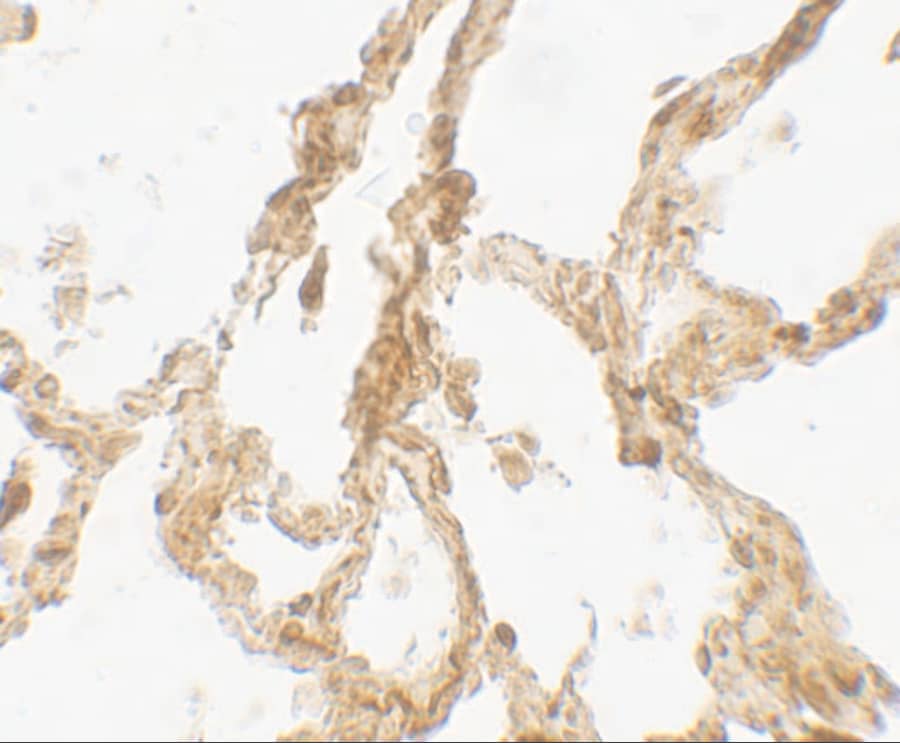 TRPV4 Antibody - BSA Free