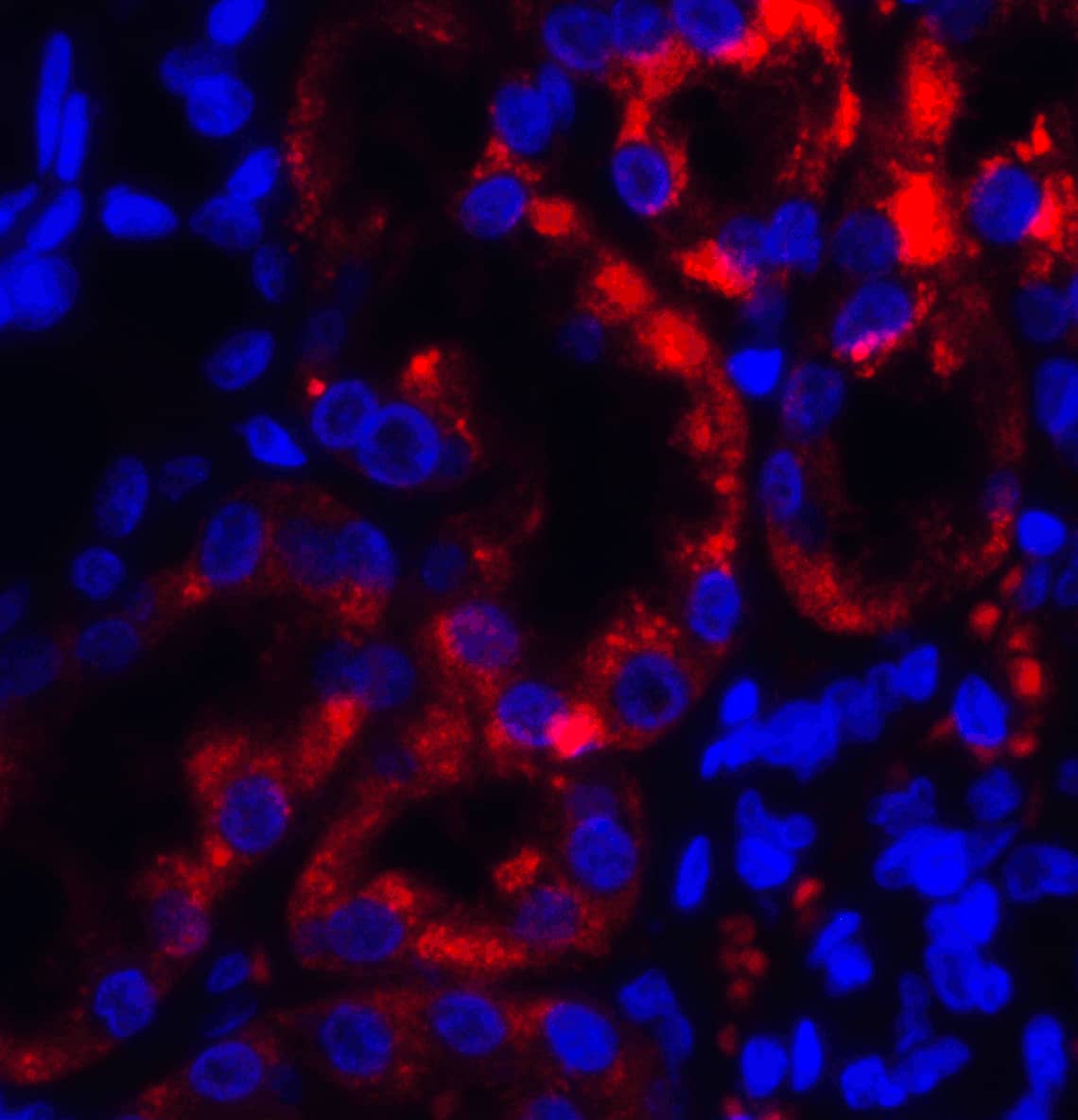 TRPV4 Antibody - BSA Free