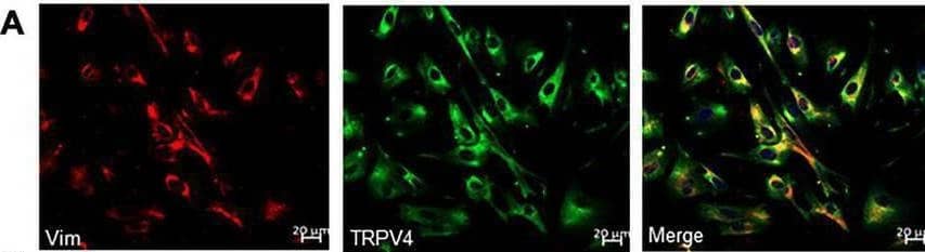 TRPV4 Antibody - BSA Free
