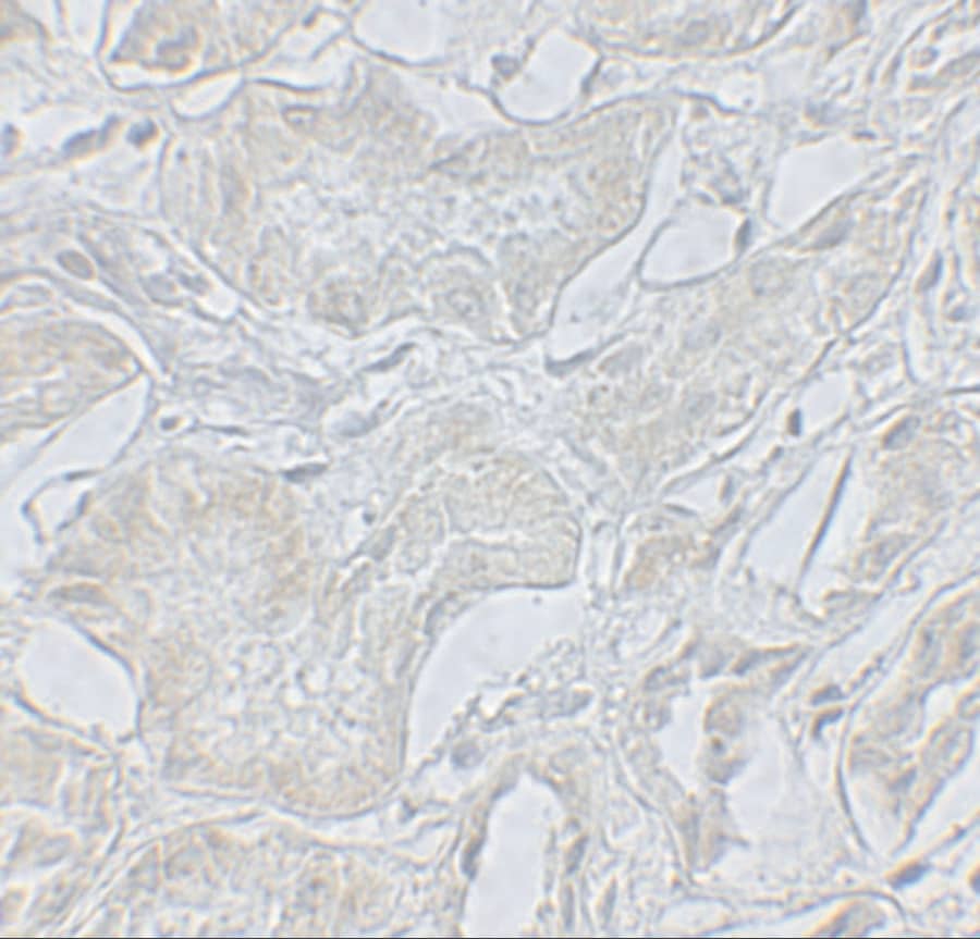 ARF6 Antibody - BSA Free