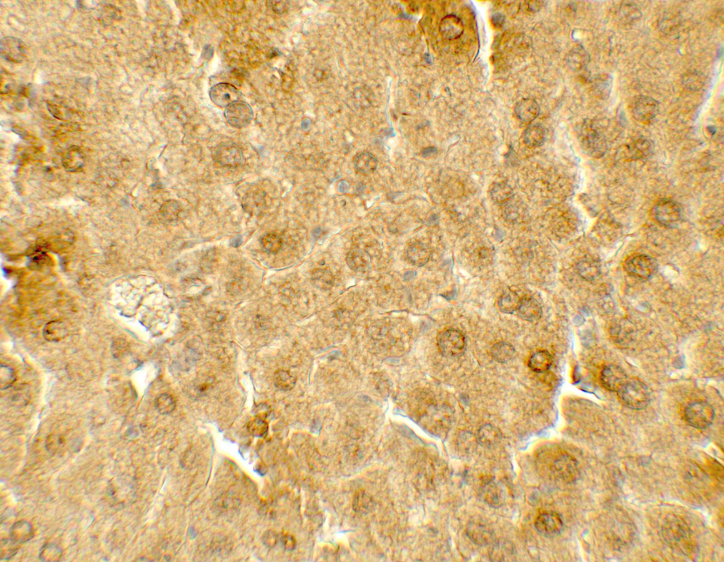 ME1 Antibody - BSA Free