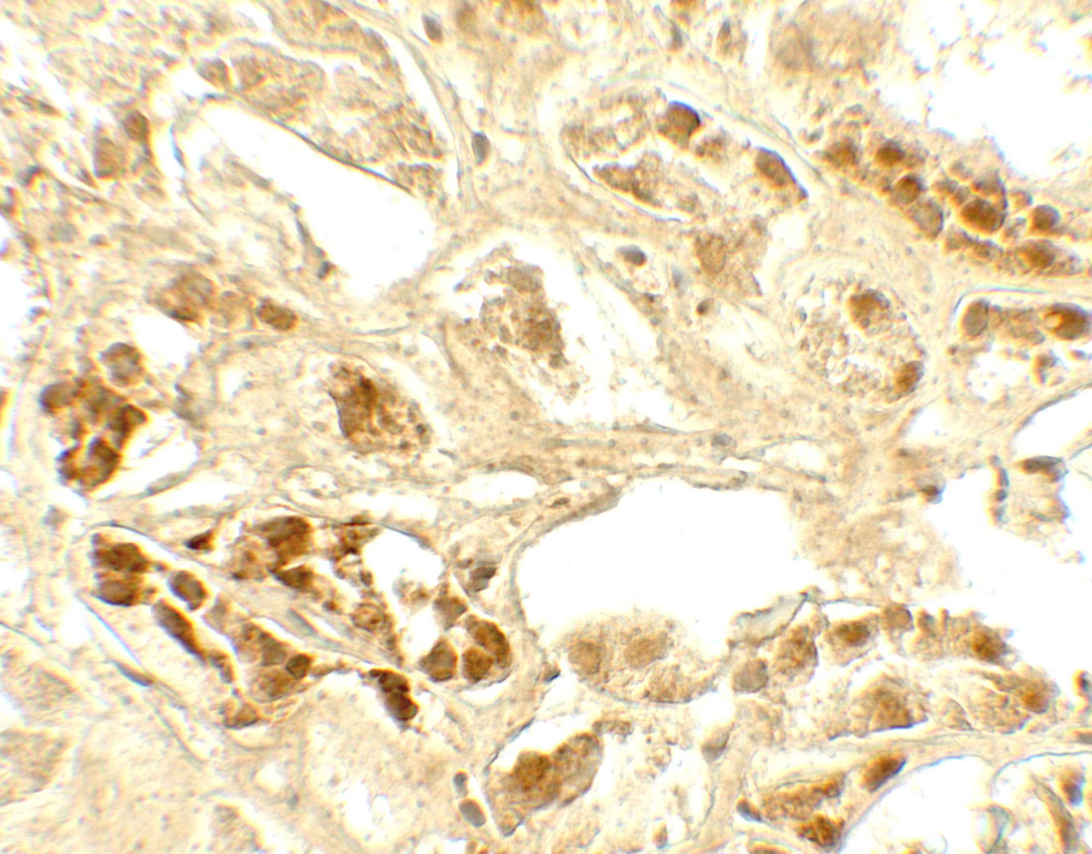 Calcium-sensing R/CaSR Antibody - BSA Free