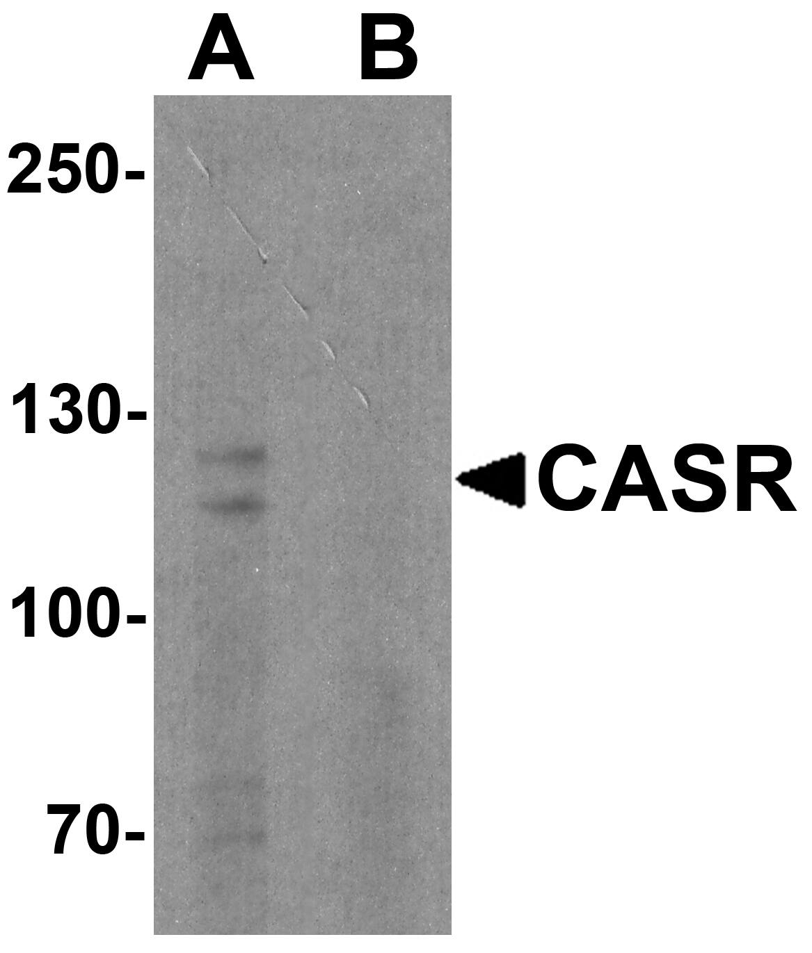Calcium-sensing R/CaSR Antibody - BSA Free