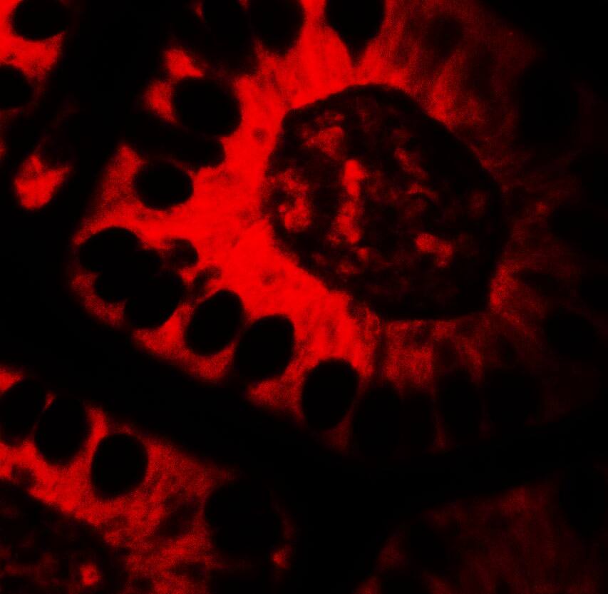 TICRR Antibody - BSA Free