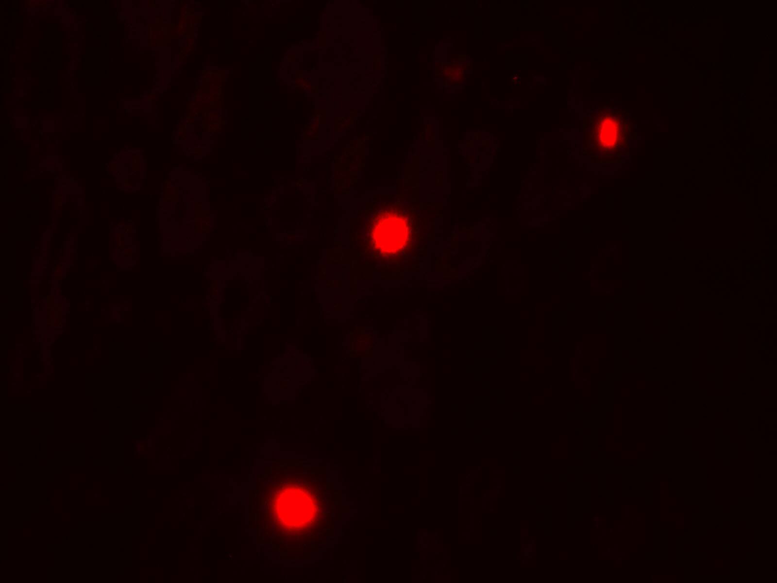 NOX1 Antibody - BSA Free