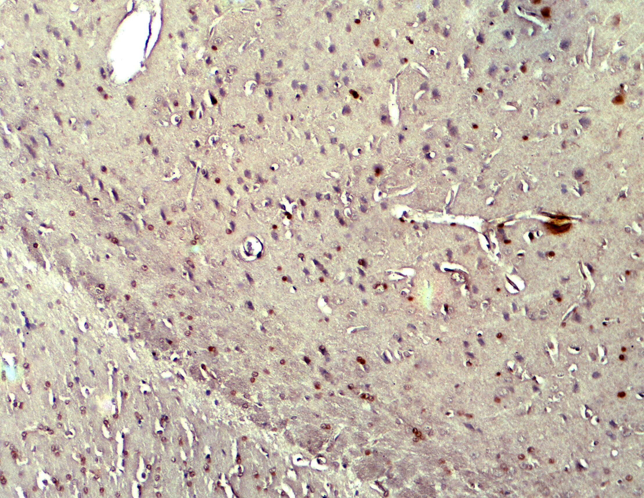 CYBB/NOX2 Antibody - BSA Free