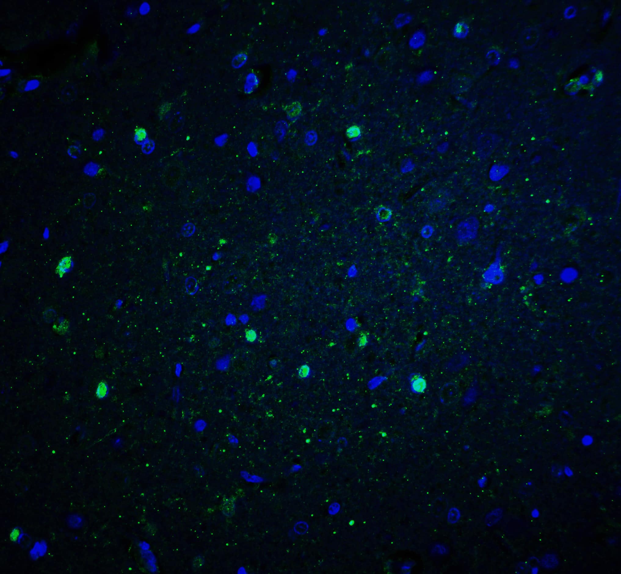 CYBB/NOX2 Antibody - BSA Free