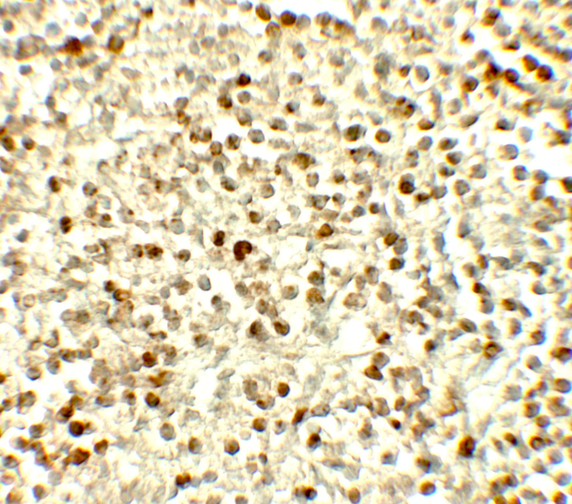 Nox4 Antibody - BSA Free