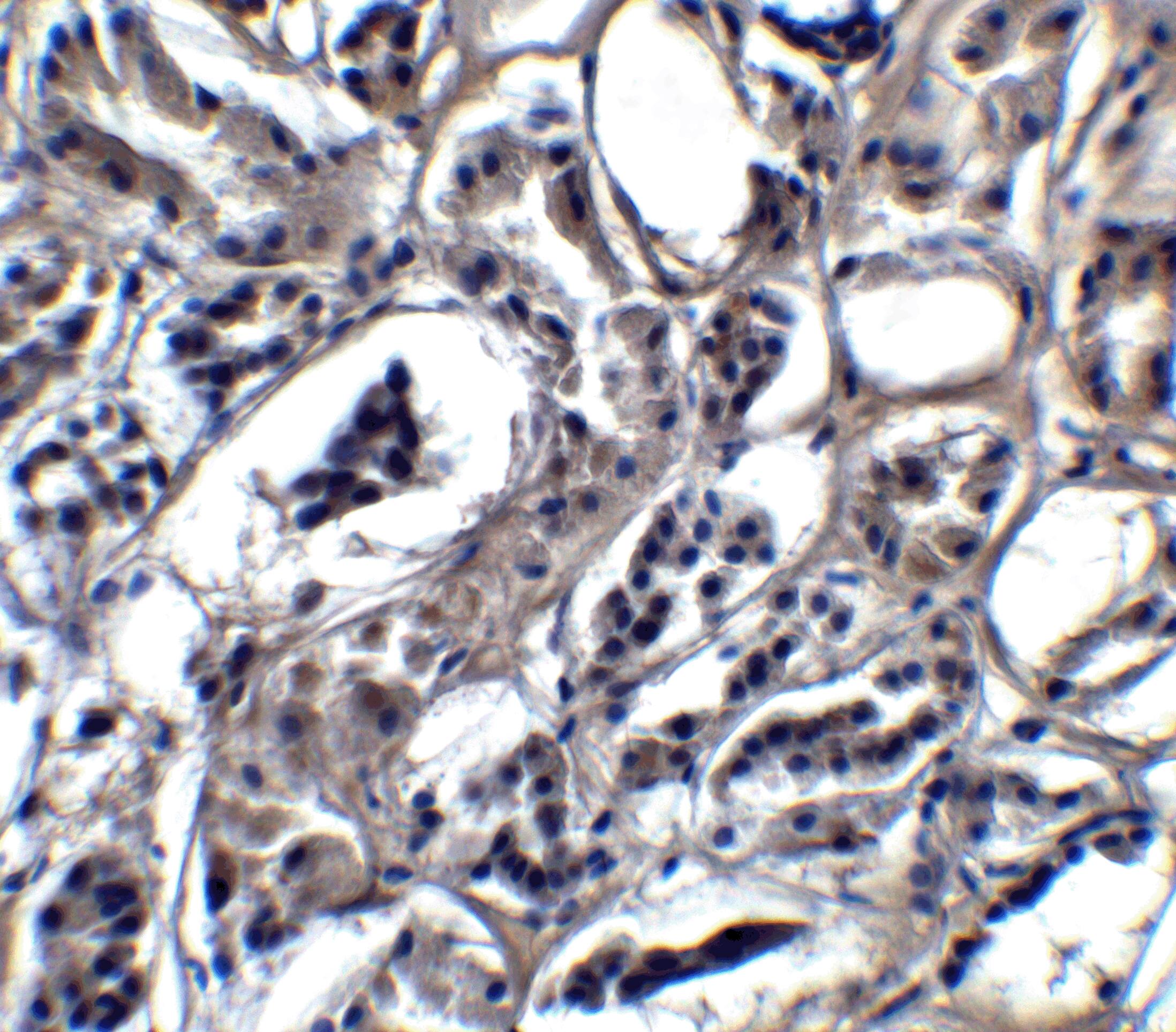 BATF3 Antibody - BSA Free