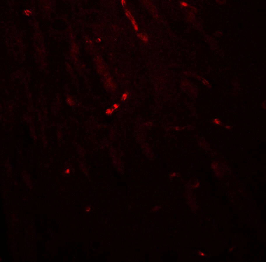 KCNK1 Antibody - BSA Free