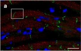 Connexin 26/GJB2 Antibody - BSA Free