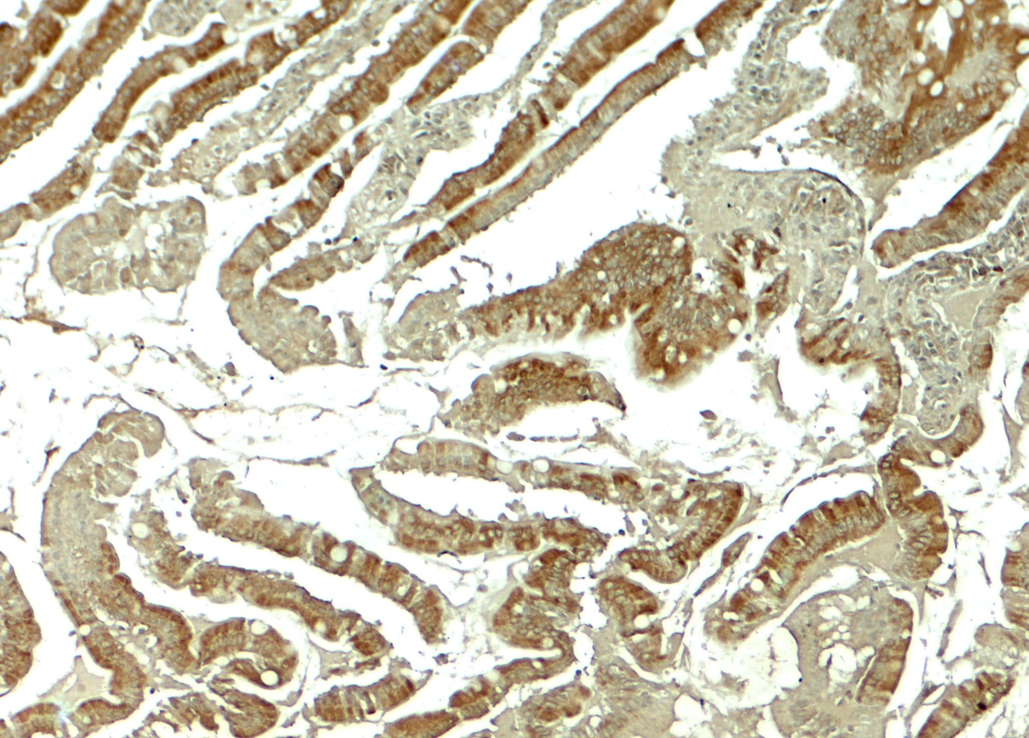 Wnt-5b Antibody - BSA Free