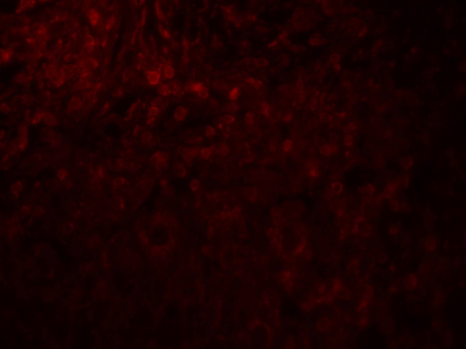 MAGEA4 Antibody - BSA Free