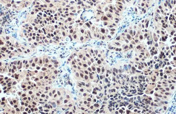 GR/NR3C1 Antibody
