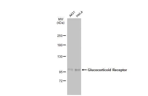 GR/NR3C1 Antibody