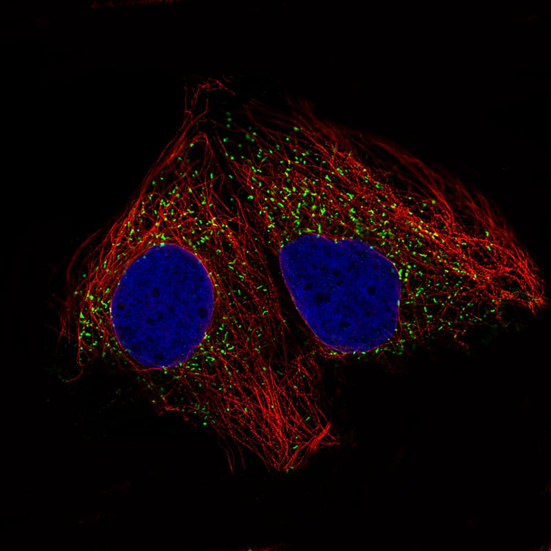 ACAA1 Antibody (CL2650) - BSA Free Immunocytochemistry/ Immunofluorescence: ACAA1 Antibody (CL2650) [NBP2-42380]