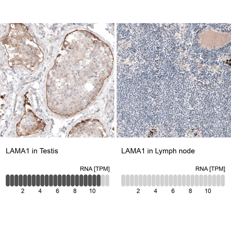 Laminin Antibody (CL3087) - BSA Free Immunohistochemistry: Laminin alpha 1 Antibody (CL3087) [NBP3-52488]