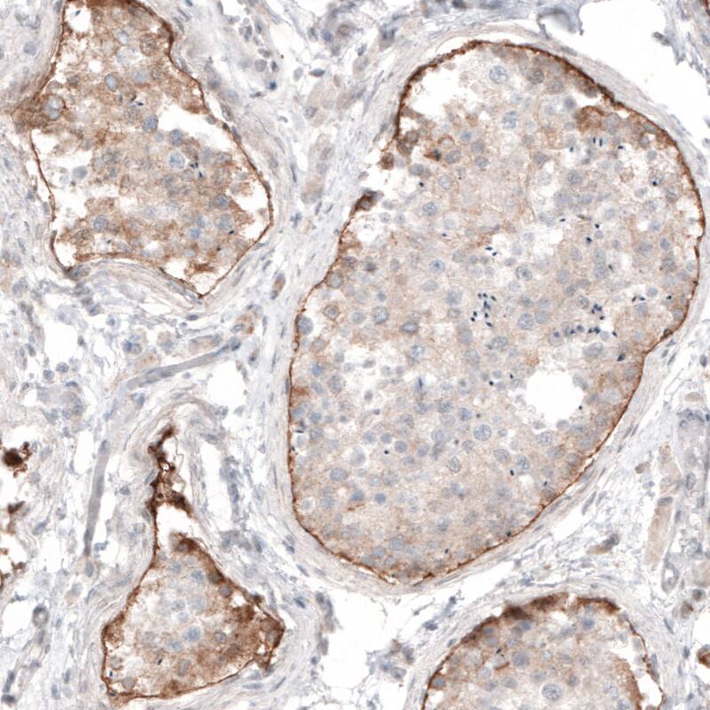 Laminin Antibody (CL3087) - BSA Free Immunohistochemistry: Laminin alpha 1 Antibody (CL3087) [NBP3-52488]