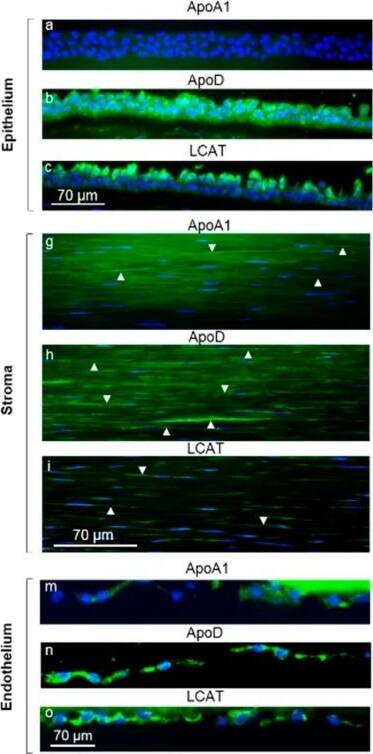 Apolipoprotein D Antibody