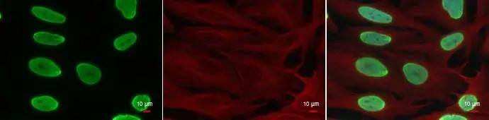 Histone H4 [ac Lys8] Antibody