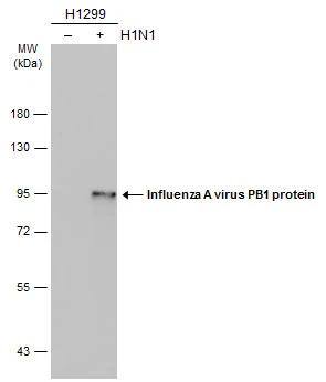 Influenza A H1N1 PB1 Antibody
