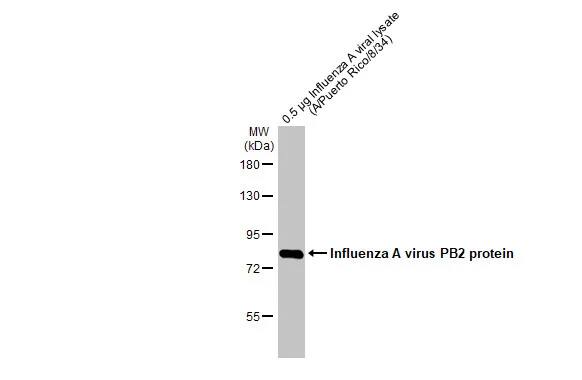Influenza A H1N1 PB2 Antibody
